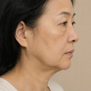 Sagging skin concern - Xovive exosome treatment