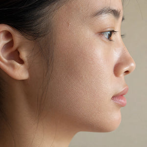 Dryness skin concern - Xovive exosome treatment